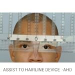 Assist to Hairline Device (AHD) - Image 4