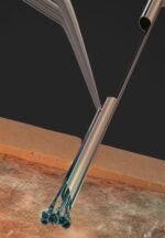 KEEP Placer - Image 3